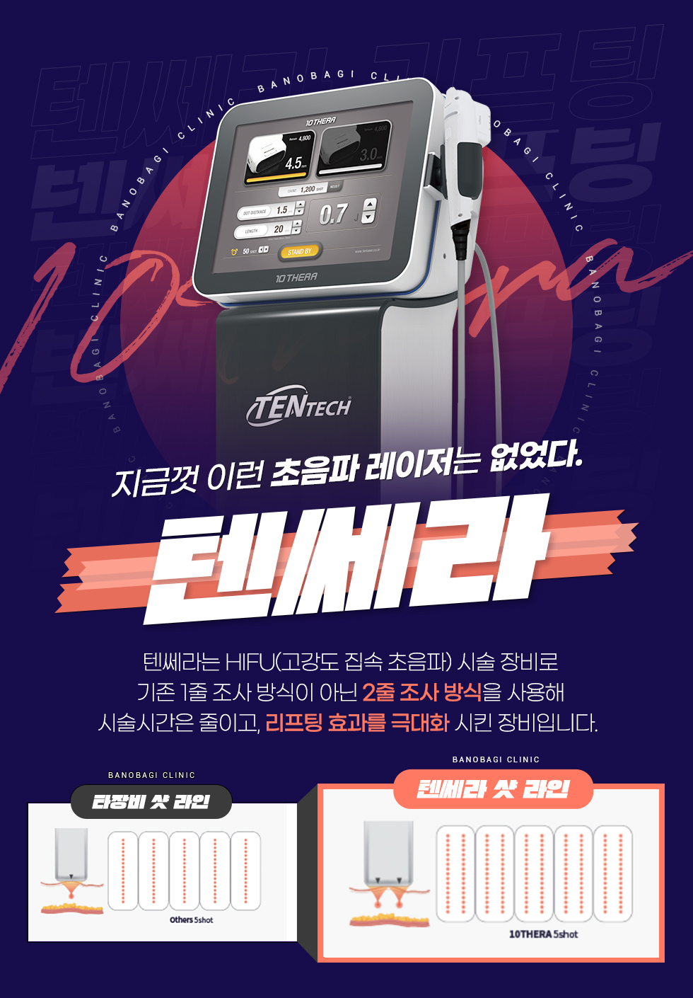 텐쎄라